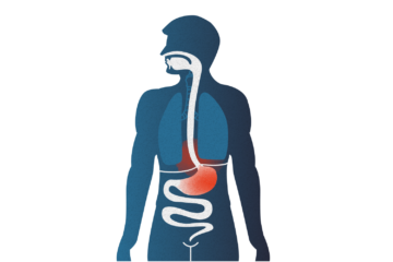020 Reflux Und Gastritis 01