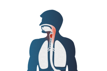 033 Laryngopharyngealer 01